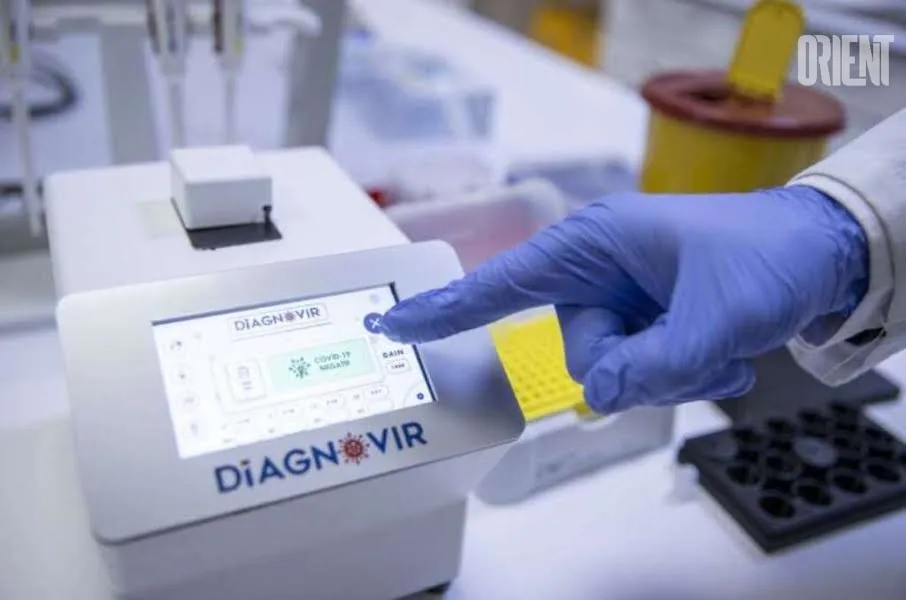Для выявления коронавируса за 10 секунд в Турции создали прибор Diagnovir